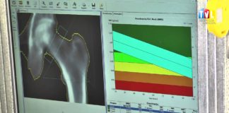 2015.08.01 – BADALI SWOJE KOŚCI