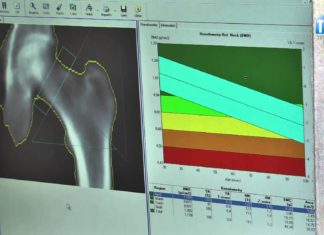 2015.08.01 – BADALI SWOJE KOŚCI